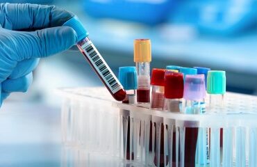 Laboratoires de biologie médicale : les actes délocalisés désormais encadrés